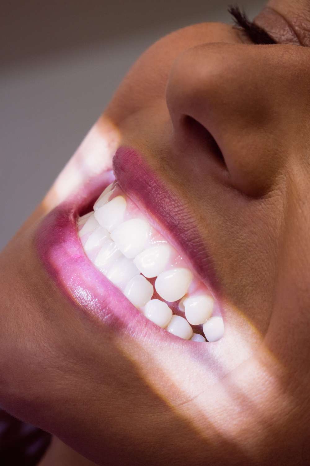 Primer plano de una persona sonriendo con los dientes blancos, la luz del sol iluminando su cara, mostrando los resultados de una visita a una clínica dental u odontólogo. de Hospital Dental de Moratalaz "Martínez y Morcuende"
